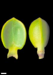 Veronica pauciramosa. Leaf surfaces, adaxial with stomata (left) and abaxial with characteristic flattening of keel (right). Scale = 1 mm.
 Image: W.M. Malcolm © Te Papa CC-BY-NC 3.0 NZ